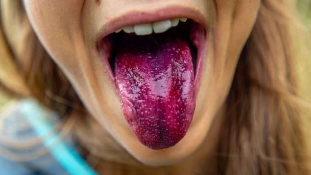 person sticks their purple stained tongue out of their mouth